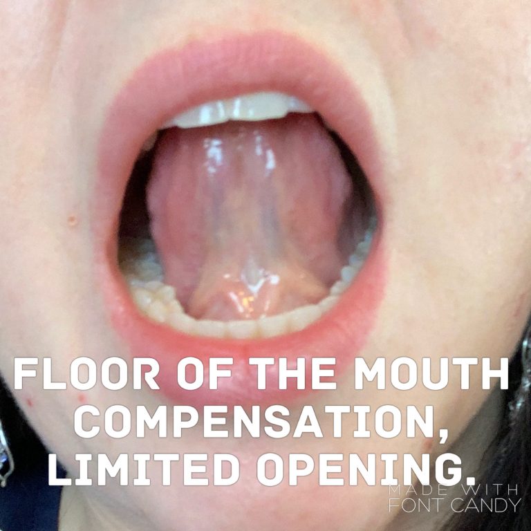 Tongue Ties – Mouth Muscle Memory Bootcamp